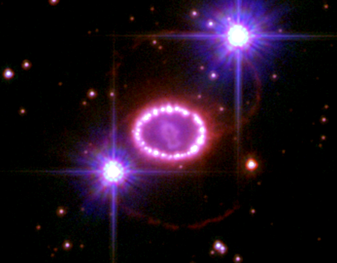 SN 1987A - Remnant of Supernova 1987A